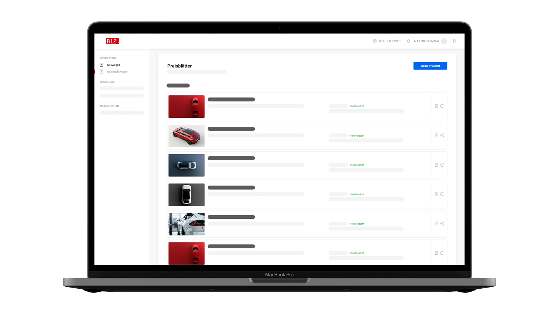 Laptop mit geöffnetem B12 Headless CMS mit Bildern von Autos und Felder, in denen Fahrzeugdaten eingepflegt werden